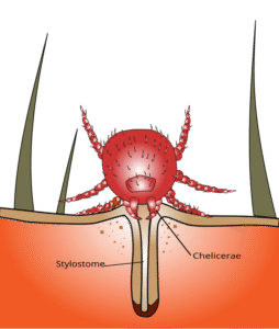 chigger bite