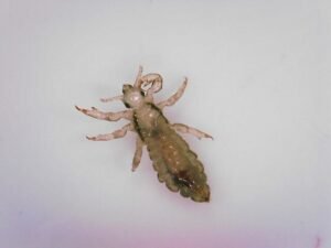 head lice