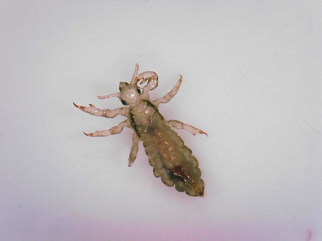 head lice