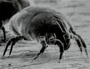house dust mites